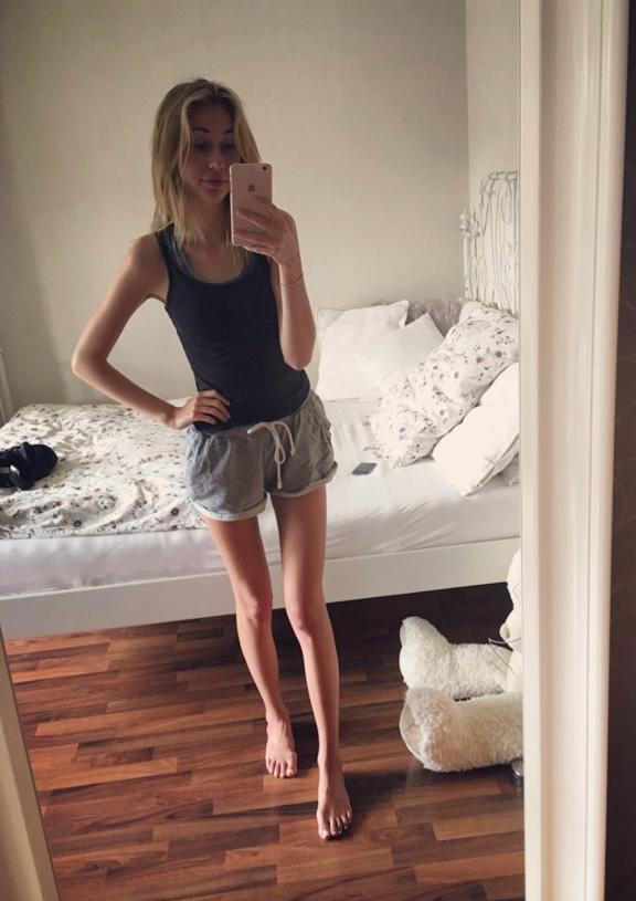 Rella vorher
